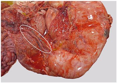 Case report: Abomasal ulcer secondary to congenital pyloric and duodenal stenosis in a 3-day-old heifer